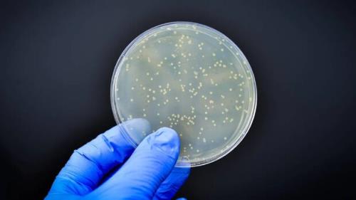 پوشش مسی جدید باکتری ها را سریع تر از بین می برد