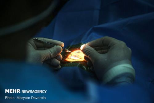 افقی تازه در درمان زخم های شدید قرنیه با استفاده از سلول های بنیادی