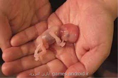 ضرورت آگاه سازی زوجین در بهره گیری از غربالگری حاملگی
